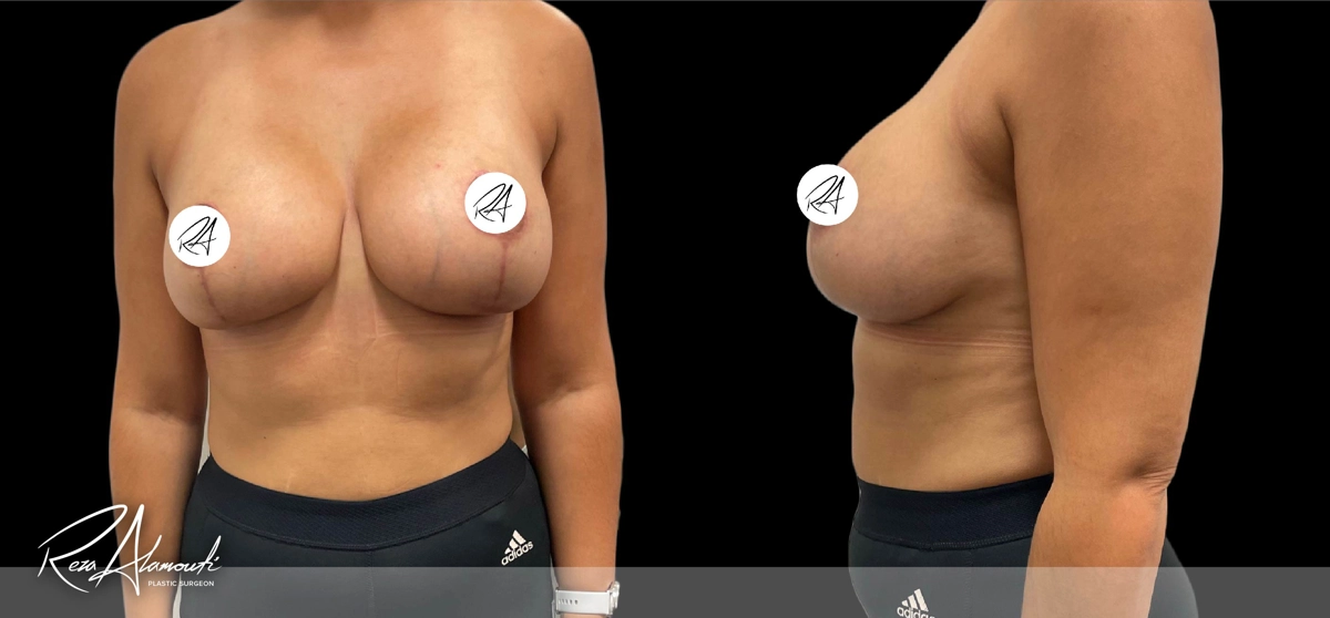 Interactive Before and After - Swipe to Reveal after image