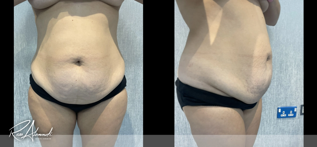 Interactive Before and After - Swipe to Reveal before image