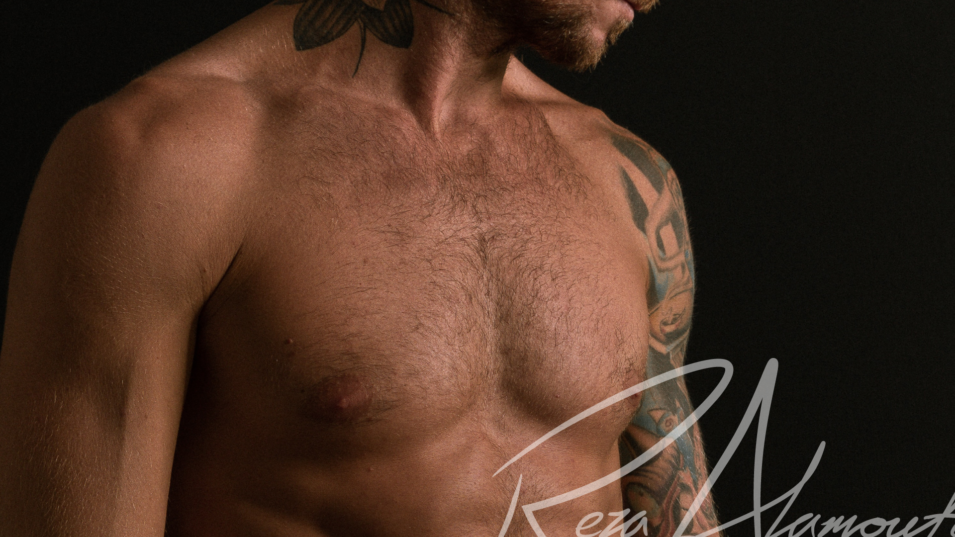 Male Breast Reduction