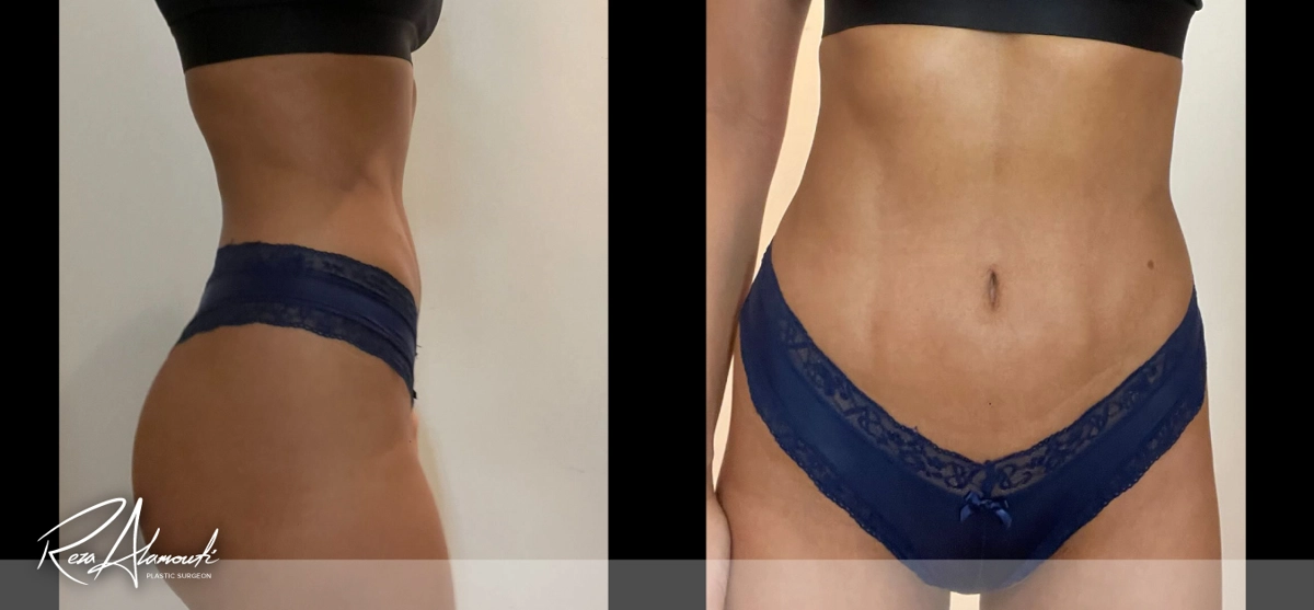 Interactive Before and After - Swipe to Reveal after image