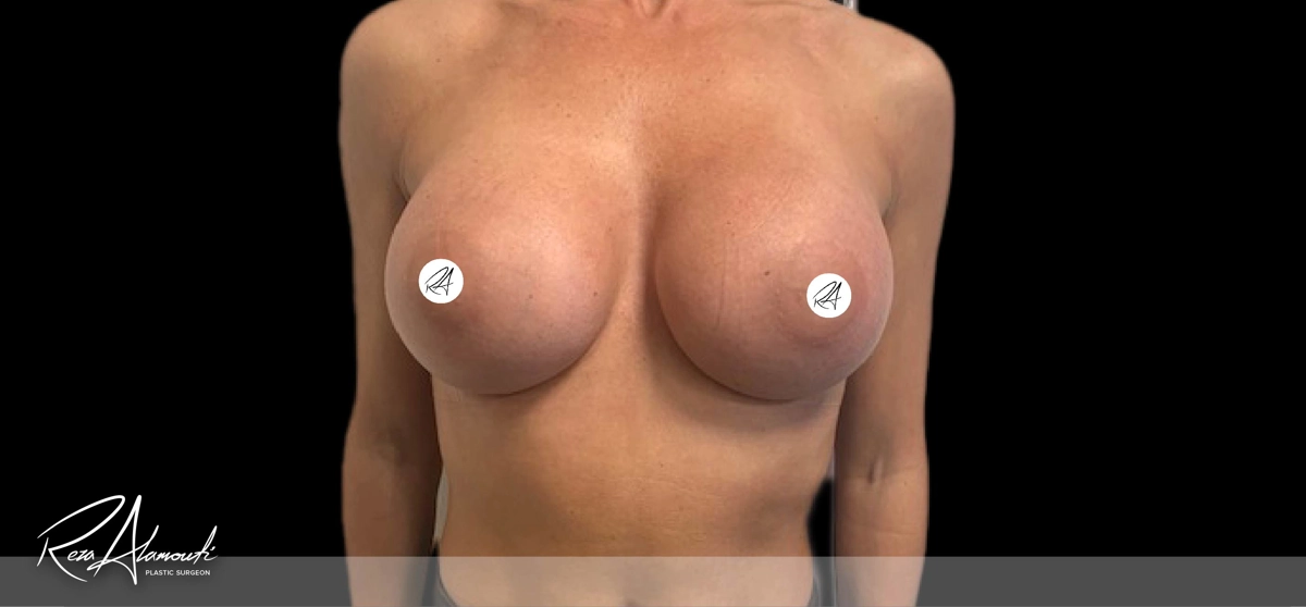 Interactive Before and After - Swipe to Reveal after image