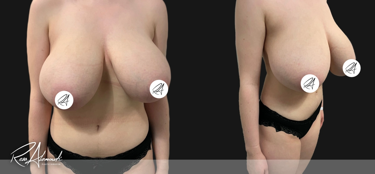 Interactive Before and After: Swipe to Reveal before image