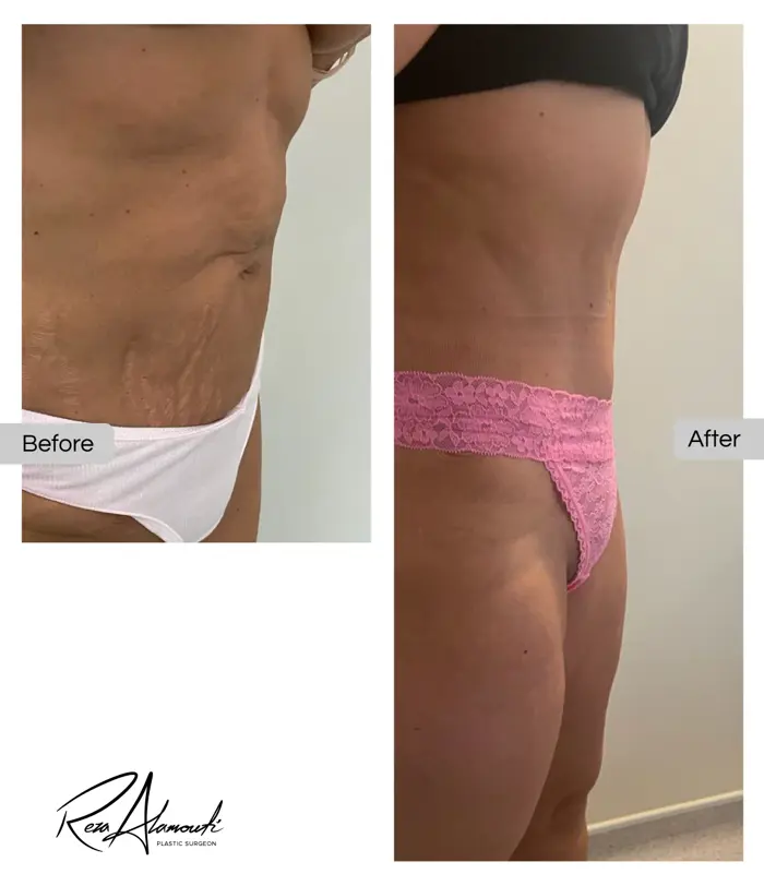 before and after
