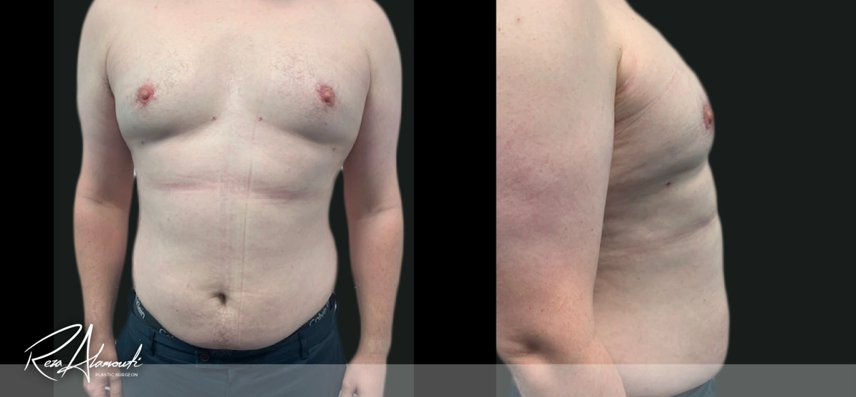 Interactive Before and After - Swipe to Reveal after image