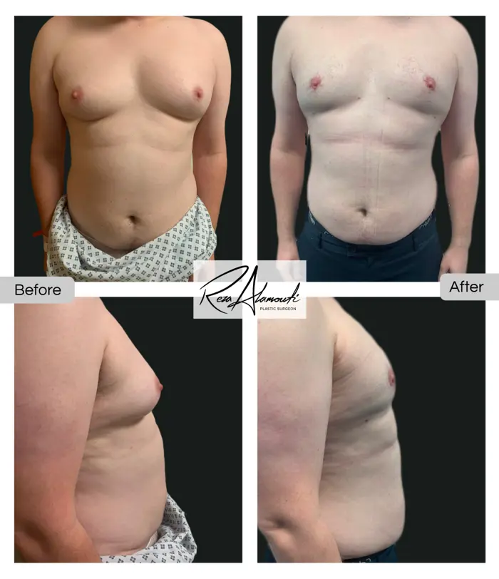 before and after