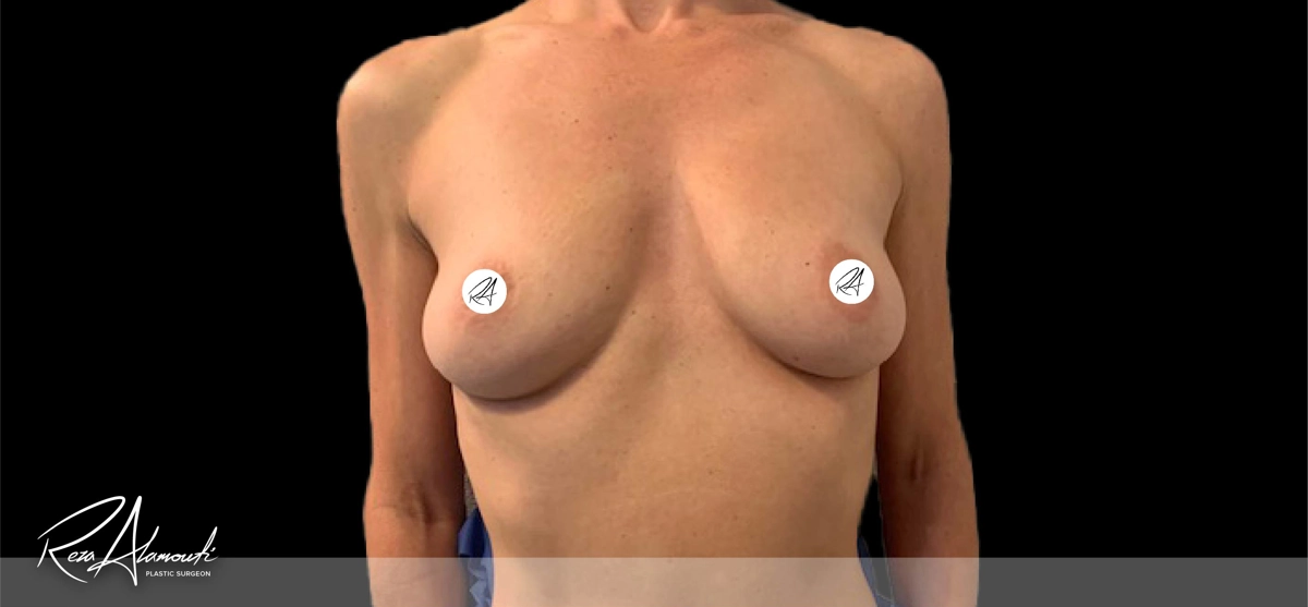 Interactive Before and After - Swipe to Reveal before image