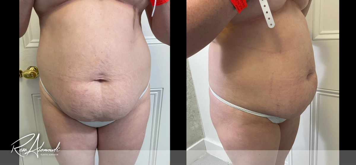 Interactive Before and After - Swipe to Reveal before image