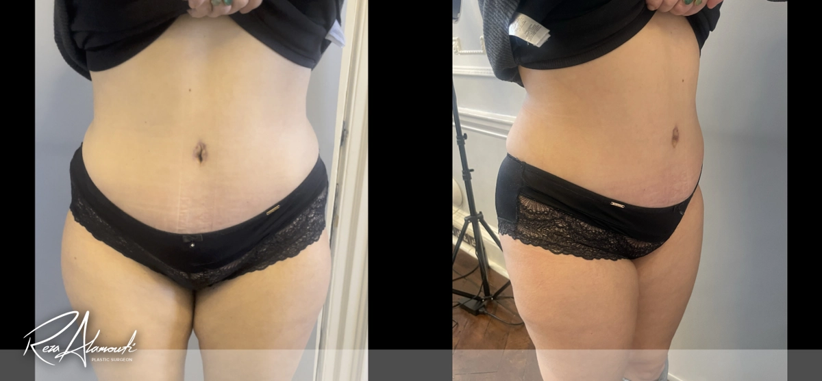 Interactive Before and After - Swipe to Reveal after image