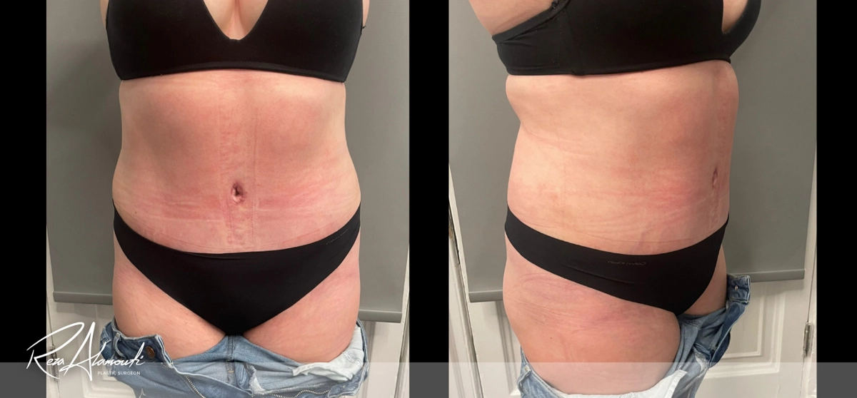 Interactive Before and After - Swipe to Reveal after image