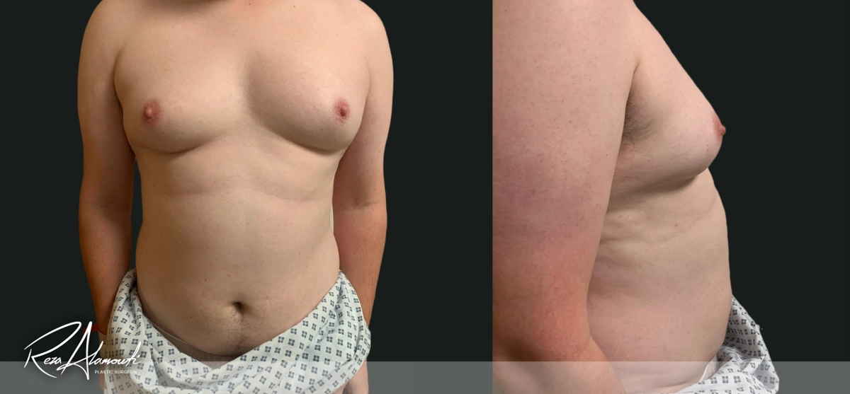 Interactive Before and After - Swipe to Reveal before image