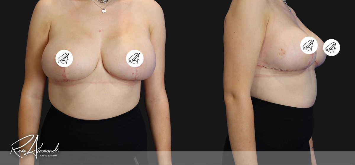 Interactive Before and After: Swipe to Reveal after image